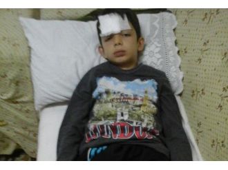 10 yaşındaki çocuğa çarpıp kaçtı