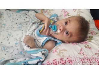 Minik Berat’ın yürek burkan yaşam mücadelesi