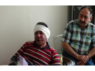 Sendika yetkilisi feci şekilde darp edildi