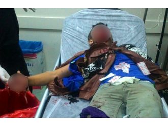 Polise atmak istediği bomba elinde patladı