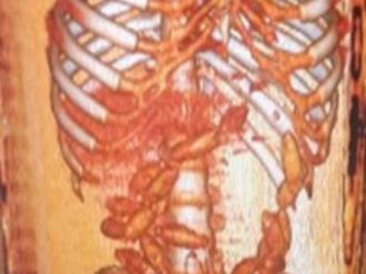 Sindirim sistemlerinden uyuşturucu çıktı