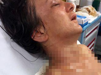 Kaynana gelinini kızgın yağla yaktı!