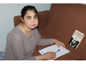 Türkiye’nin yüz nakli yapılan ilk kadını hayatını kaybetti