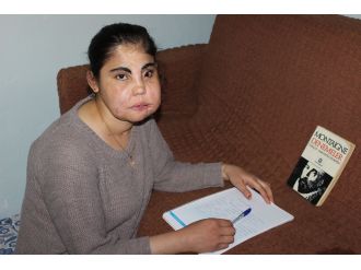 Türkiye’de yüz nakli yapılan ilk kadın son yolcuğuna uğurlandı