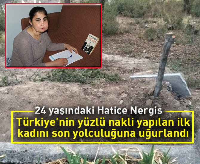 Türkiye’nin yüzlü nakli yapılan ilk kadını son yolculuğuna uğurlandı