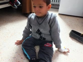 Kafasından midesine uzanan hortumla yaşıyor: Sadece 5 yaşında