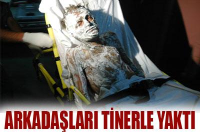 Arkadaşları tarafından tinerle yakıldı