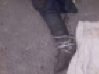 Çöpten çıkan bacağın sırrını kayıp başvuruları çözecek