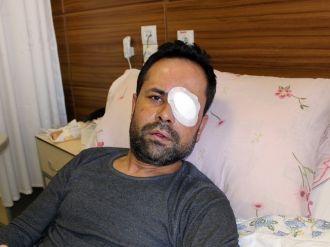 Servisi beğenmedi, garsonu gözünden etti