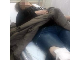 Barışmaya çağırdığı eski eşini bacağından vurdu