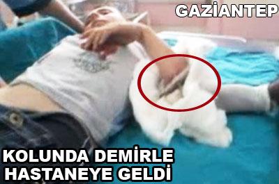 Kolunda demirle hastaneye geldi