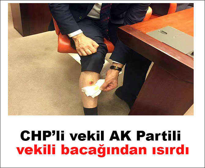 CHP’li vekil AK Partili vekil Muhammet Balta'yı bacağından ısırdı