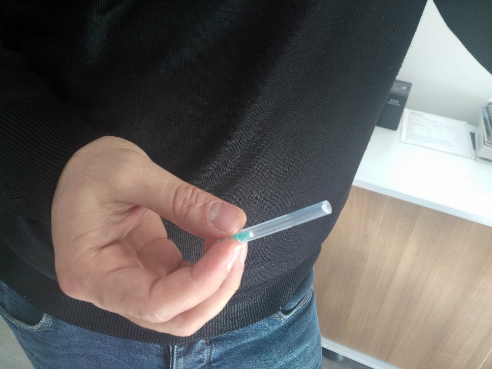 Kadının şırıngalı saldırısına uğradı