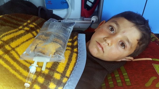 Suriye’de bacakları kopan çocuk Türkiye’ye getirildi