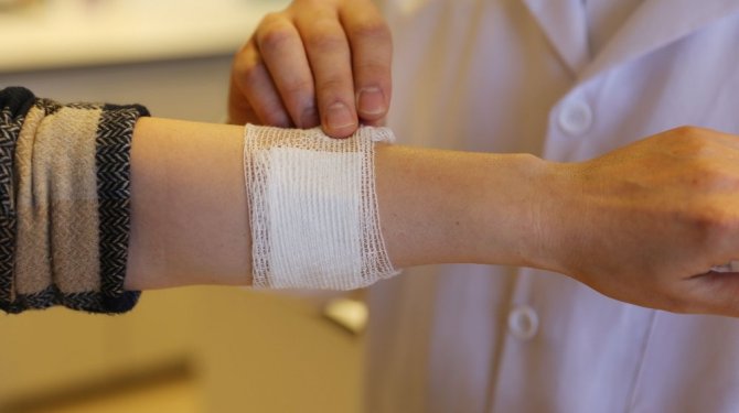 Kozadan yara bandı üretildi