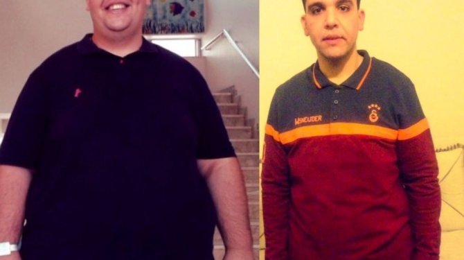 17 ayda verdiği 85 kilo ile hayata yeniden tutundu