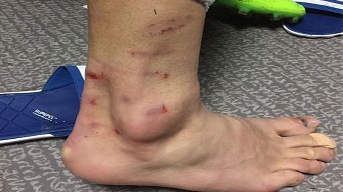 Volkan Şen isyan etti