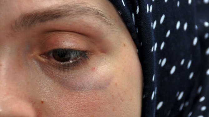 Almanya’da 3 Türk kadınına saldırı