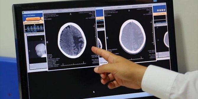 BEYİN HÜCRELERİNİN YENİDEN PROGRAMLANMASI PARKİNSON'A ÇARE OLABİLİR