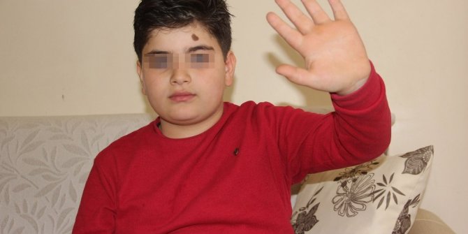 ENGELLİ ÇOCUĞA ’YAVAŞ’ YÜRÜDÜĞÜ İÇİN SALDIRDILAR