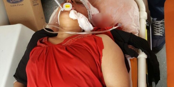 PKK/PYD SİVİLLERİ VURMAYA DEVAM EDİYOR