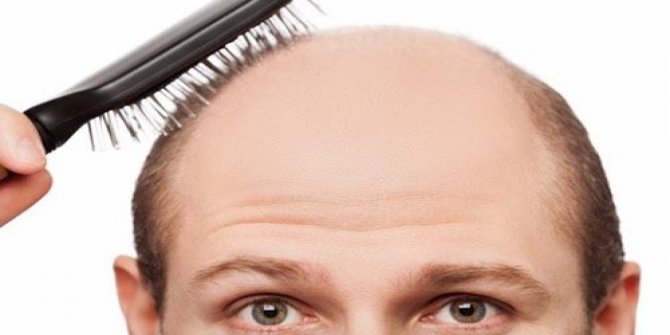 KELLİĞİN ÇÖZÜMÜ YANLIŞLIKLA BULUNDU!