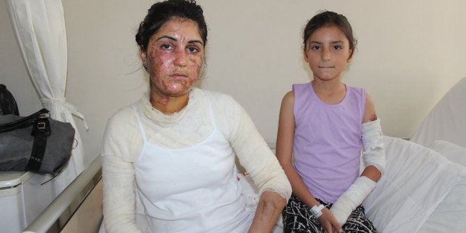 KİMLİĞİ BELİRSİZ İKİ KİŞİNİN ASİTLİ SALDIRISINA UĞRADILAR