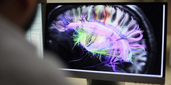 DELİRYUMUN NEDENİ BULUNDU