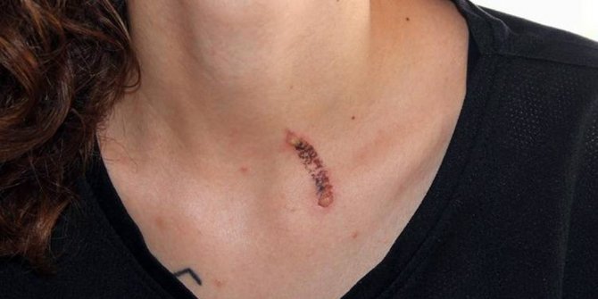 O MAGANDA TUTUKLANDI