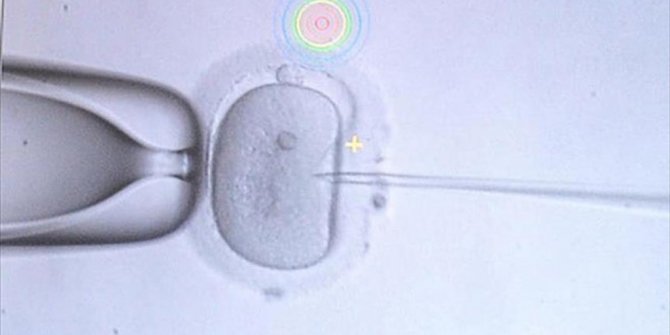 'Tüp bebek tedavisinde suistimallere dikkat'