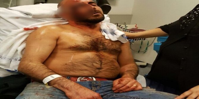 TÜRK VATANDAŞINA ERDOĞAN'I SEVDİĞİ İÇİN BUNU YAPTILAR!