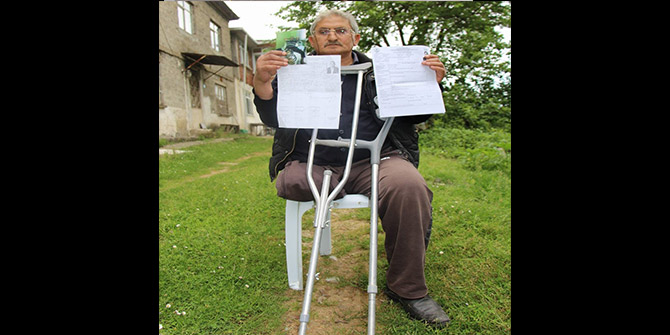 BİR AYAĞI YOK AMA MALULEN EMEKLİ EDİLMEDİ