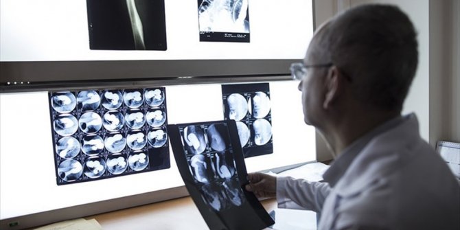 RADYASYON ÇOCUKLARDA KANSER RİSKİNİ 5 KAT ARTIRABİLİYOR