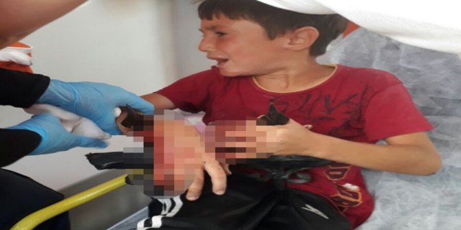 KÜÇÜK ÇOCUĞUN KOLUNA DEMİR SAPLANDI