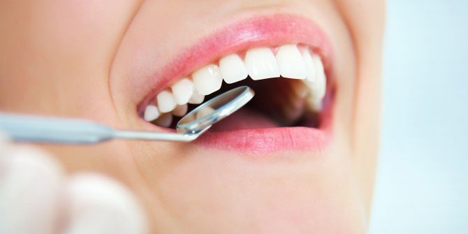 "DİŞ ÇÜRÜKLERİ KANSERE BİLE NEDEN OLABİLİR"