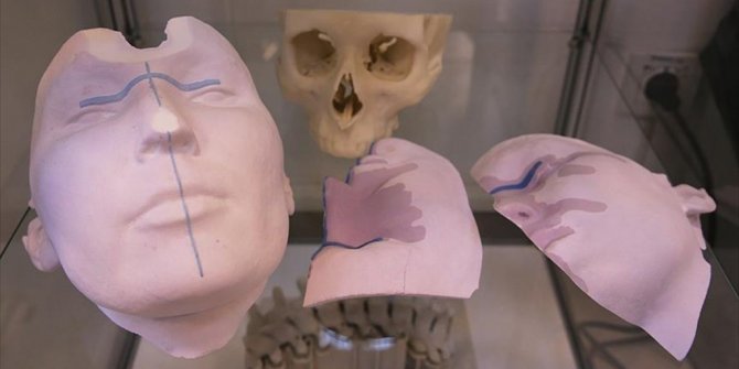 TİTANYUMDAN 'VÜCUT PARÇASI' ÜRETİLİYOR