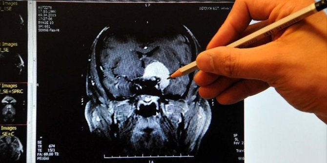 KADINLARIN BEYİNLERİ ERKEKLERİNKİNDEN DAHA AKTİF