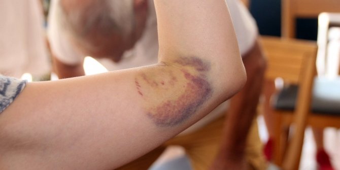 JAPON HEYETE CARETTA CARETTA SALDIRDI