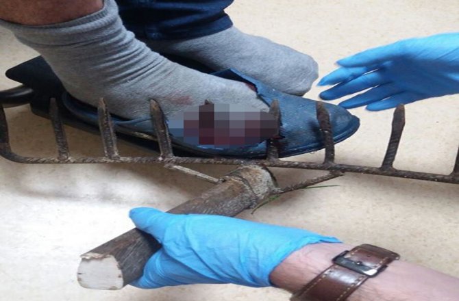 AYAĞINA SAPLANAN TIRMIKLA HASTANEYE GELDİ