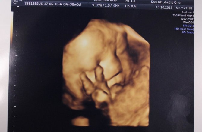 ANNE KARNINDA ZAFER İŞARETİ