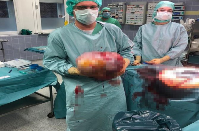 İKİZ BEBEK SANDILAR: KARNINDAN BU ÇIKTI