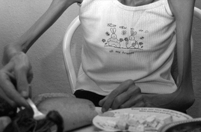 'ANOREKSİYA SONU ÖLÜMLE BİTEBİLEN BİR HASTALIKTIR'