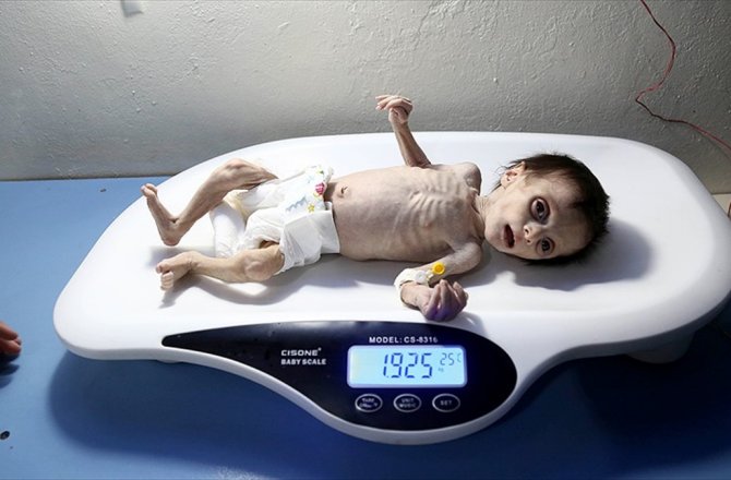 BM'DEN ESED'E 'DOĞU GUTA'YA YARDIM GİRİŞİNE İZİN VER' ÇAĞRISI