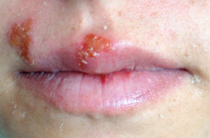 UÇUK DEYİP GEÇMEYİN