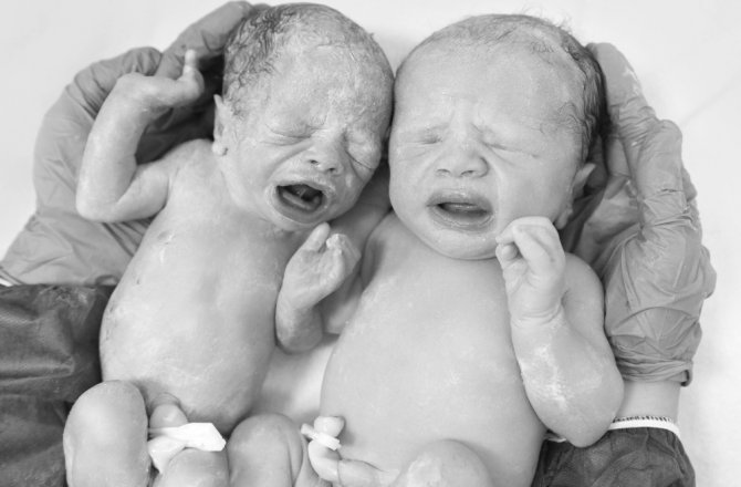 İZMİR’DE TIP TARİHİNE GEÇECEK OLAY 