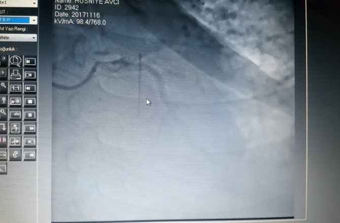 TÜRKİYE’DE İLK KEZ YAŞANDI !