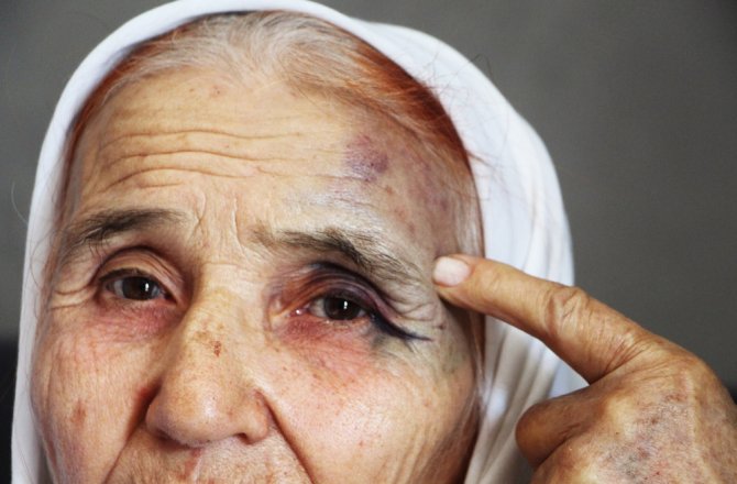 80 YAŞINDAKİ KADINA SOKAK ORTASINDA DAYAK