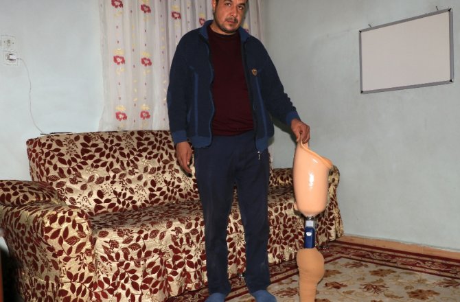 ÖLEN EŞİNİN PROTEZ BACAĞINI BAĞIŞLAMAK İSTİYOR