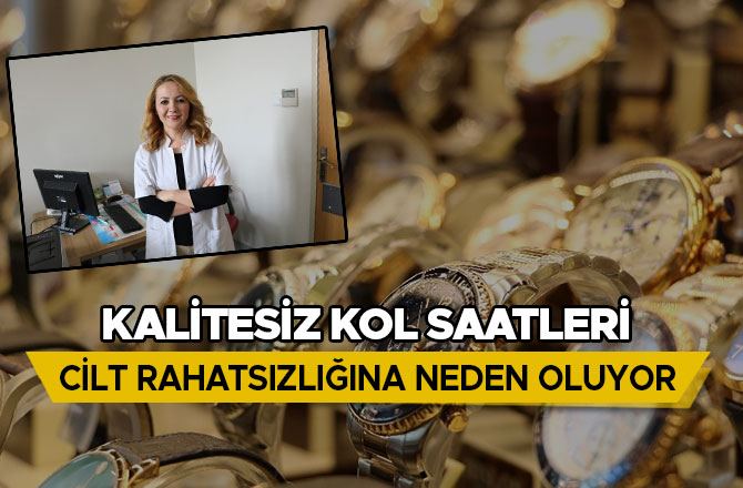 KALİTESİZ KOL SAATLERİ CİLT RAHATSIZLIĞINA NEDEN OLUYOR