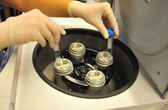 KALITSAL HASTALIĞI OLAN ÇİFTLERE TÜP BEBEK DESTEĞİ